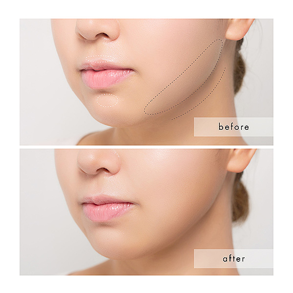 �qSNIDEL BEAUTY/�X�i�C�f�� �r���[�e�B�rSNIDEL �R���g�D�A�����O �p���b�g 02